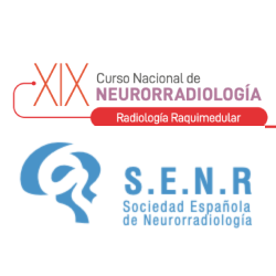 XIX Curso Nacional de Neurorradiología. Radiología Raquimedular.